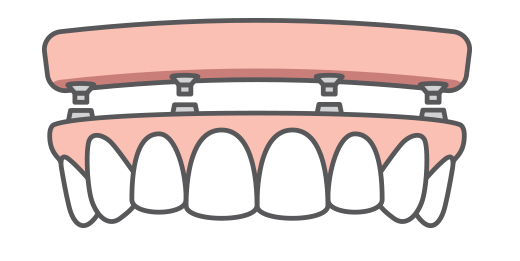 full-arch replacement icon