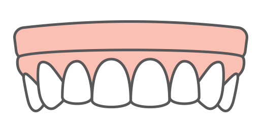 Implant-supported dentures icon