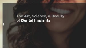 Dental implants ebook